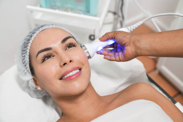 Laser Toning For Skin Brightening